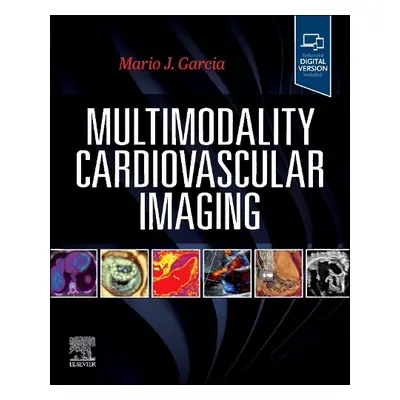 Multimodality Cardiovascular Imaging