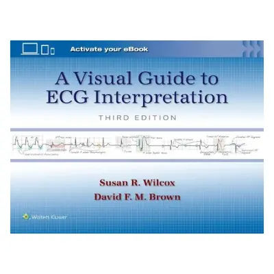 Visual Guide to ECG Interpretation: Print + eBook with Multimedia - Wilcox, Susan Renee a BROWN,