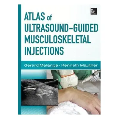 Atlas of Ultrasound-Guided Musculoskeletal Injections - Malanga, Gerard a Mautner, Kenneth