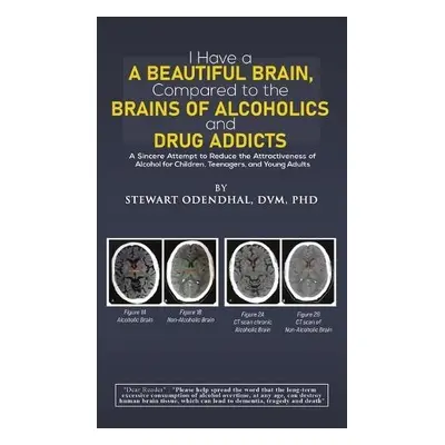 I Have a Beautiful Brain, Compared to the Brains of Alcoholics and Drug Addicts - Odendhal, DVM,