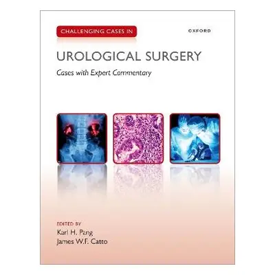 Challenging Cases in Urological Surgery