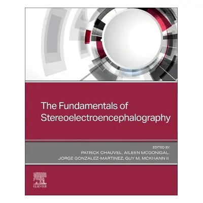 Fundamentals of Stereoelectroencephalography