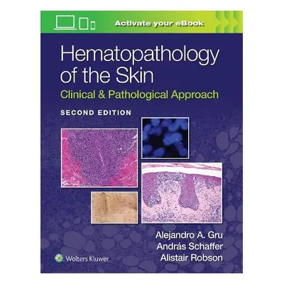 Hematopathology of the Skin - Gru, Alejandro Ariel a SCHAFFER, ANDRAS a ROBSON, ALISTAIT