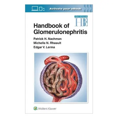 Handbook of Glomerulonephritis - Nachman, Patrick Henry a Lerma, Edgar a Rheault, Michelle