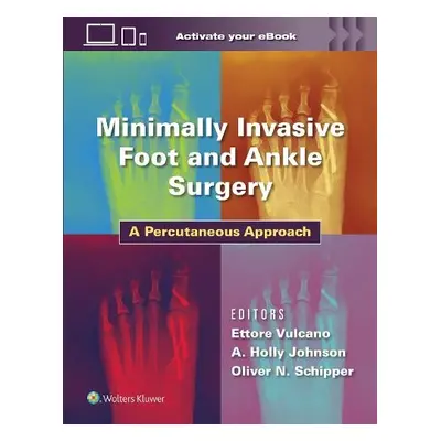 Minimally Invasive Foot and Ankle Surgery - Vulcano, Dr. Ettore, MD a Johnson, A. Holland, MD a 