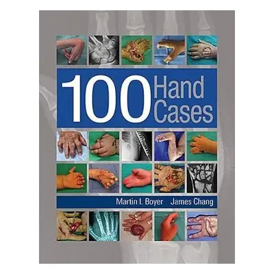 100 Hand Cases - Boyer, Martin a Chang, James