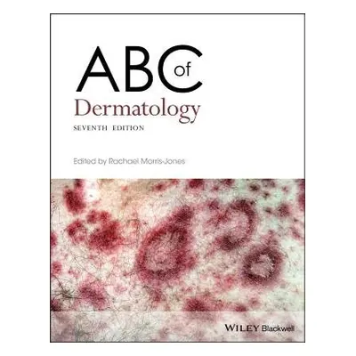 ABC of Dermatology