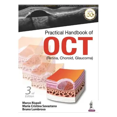 Practical Handbook of OCT - Rispoli, Marco a Savastano, Maria Cristina a Lumbroso, Bruno