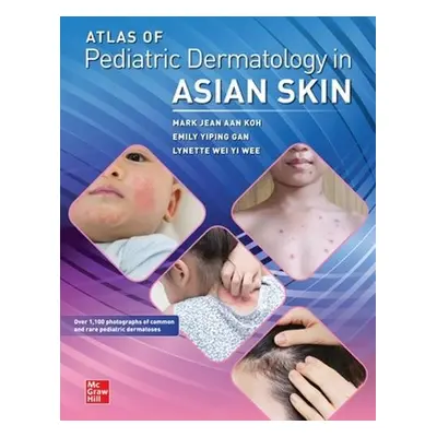 Atlas of Pediatric Dermatology in Asian Skin - Koh, Mark Jean Aan a Gan, Emily Yiping a Wee, Lyn