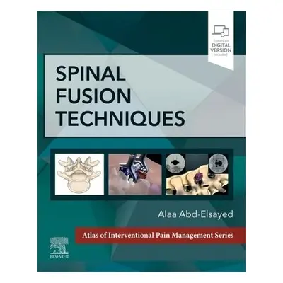 Spinal Fusion Techniques - Abd-Elsayed, Alaa, MD, MPH, FASA (Medical Director, UW Pain Clinic, D