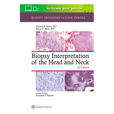 Biopsy Interpretation of the Head and Neck - Stelow, Edward B. a Mills, Stacey