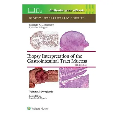 Biopsy Interpretation of the Gastrointestinal Tract Mucosa Volume 2 - MONTGOMERY, ELIZABETH ANNE