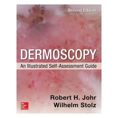 Dermoscopy: An Illustrated Self-Assessment Guide, 2/e - Johr, Robert a Stolz, Wilhelm