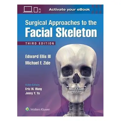 Surgical Approaches to the Facial Skeleton - Ellis, III, Edward, DDS a Zide, Michael F.