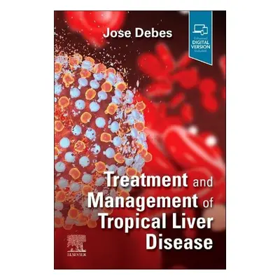 Treatment and Management of Tropical Liver Disease