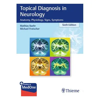 Topical Diagnosis in Neurology - Bahr, Mathias a Frotscher, Michael