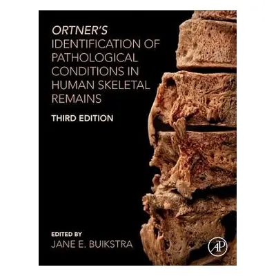 Ortner's Identification of Pathological Conditions in Human Skeletal Remains