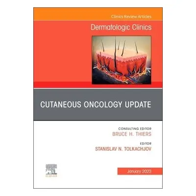 Cutaneous Oncology Update, An Issue of Dermatologic Clinics