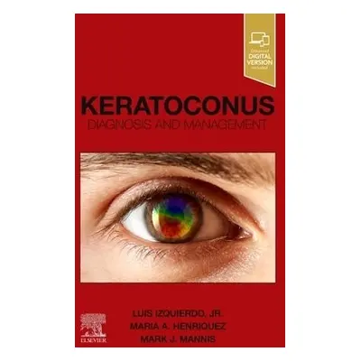 Keratoconus