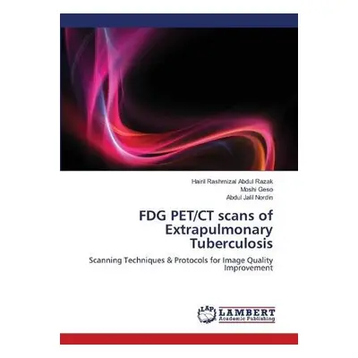 FDG PET/CT scans of Extrapulmonary Tuberculosis - Abdul Razak, Hairil Rashmizal a Geso, Moshi a 