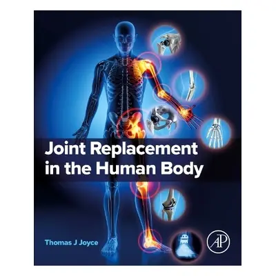 Joint Replacement in the Human Body - Joyce, Thomas J, PhD (Professor of Orthopaedic Engineering