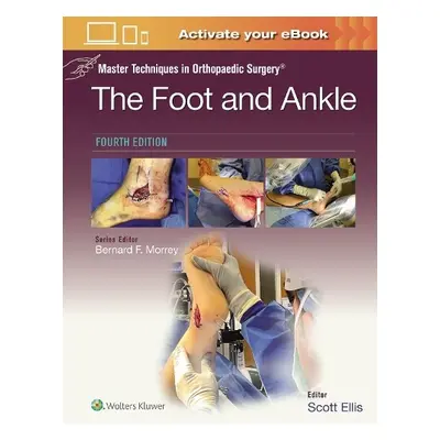 Master Techniques in Orthopaedic Surgery: The Foot and Ankle: Print + eBook with Multimedia - El