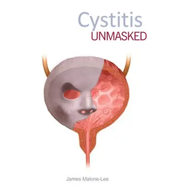 Cystitis Unmasked