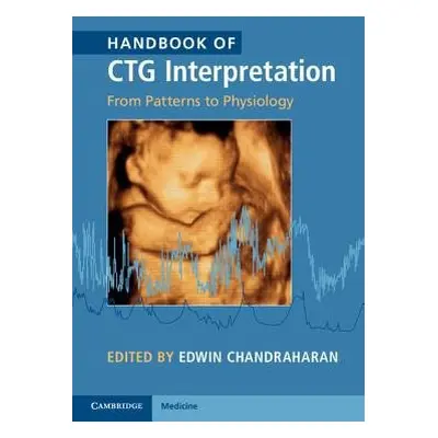 Handbook of CTG Interpretation