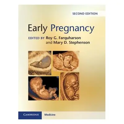 Early Pregnancy