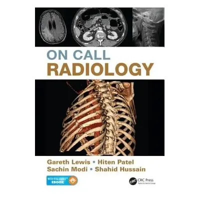 On Call Radiology - Lewis, Gareth a Modi, Sachin a Patel, Hiten a Hussain, Shahid (Heart of Engl