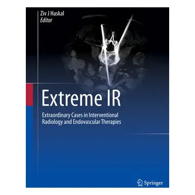 Extreme IR