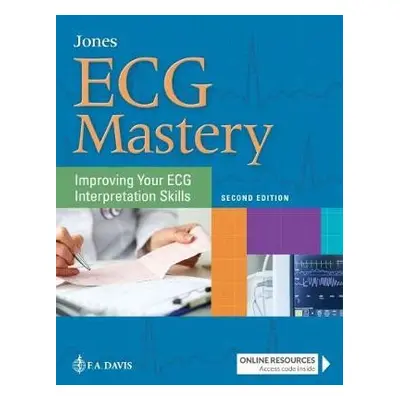 ECG Mastery - Jones, Shirley A.