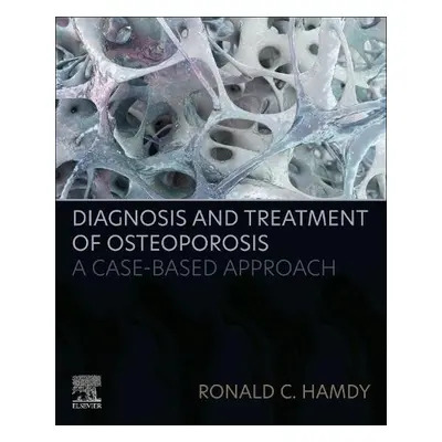 Diagnosis and Treatment of Osteoporosis - Hamdy, Ronald C.