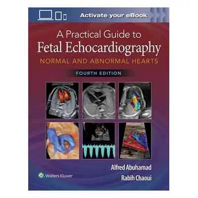 Practical Guide to Fetal Echocardiography - Abuhamad, Alfred Z. a Chaoui, Rabih