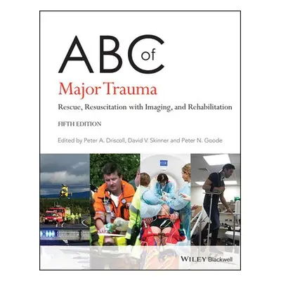 ABC of Major Trauma