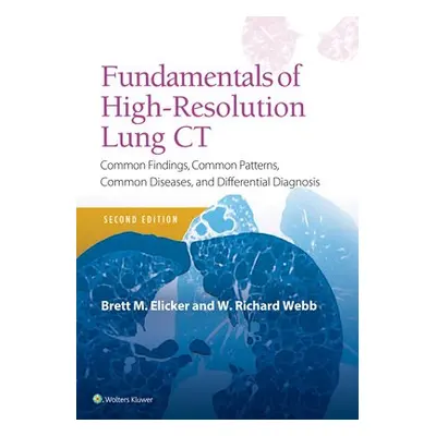 Fundamentals of High-Resolution Lung CT - Elicker, Brett M, MD a Webb, W. Richard