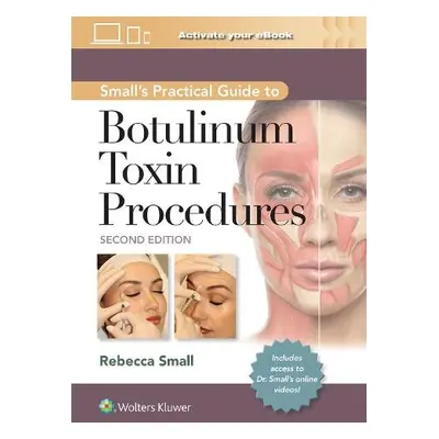 Small's Practical Guide to Botulinum Toxin Procedures - Small, Rebecca