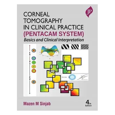 Corneal Tomography in Clinical Practice (Pentacam System) - Sinjab, Mazen M