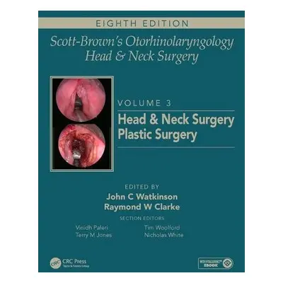 Scott-Brown's Otorhinolaryngology and Head and Neck Surgery