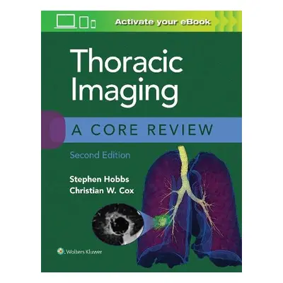 Thoracic Imaging: A Core Review - Hobbs, Stephen a Cox, Christian