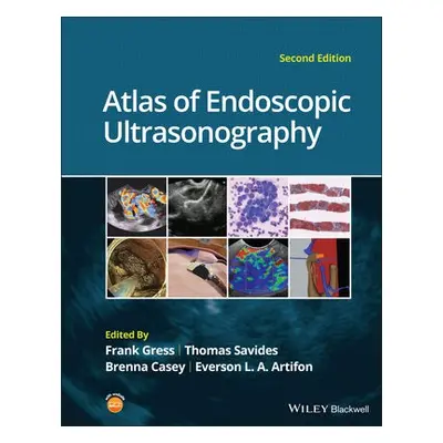 Atlas of Endoscopic Ultrasonography