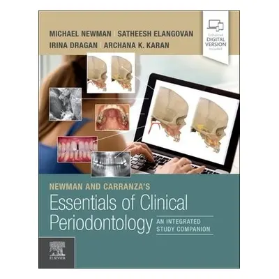 Newman and Carranza's Essentials of Clinical Periodontology