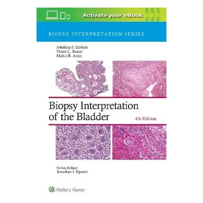 Biopsy Interpretation of the Bladder - Epstein, Jonathan I. a Reuter, Victor E., M.D. a Amin, Ma