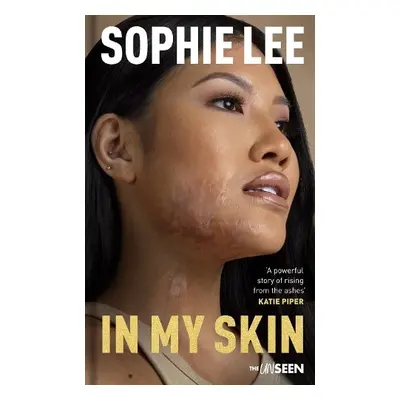 In My Skin - Lee, Sophie