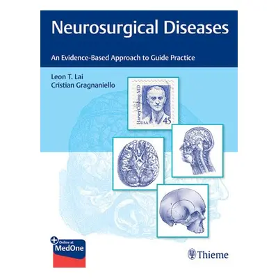 Neurosurgical Diseases