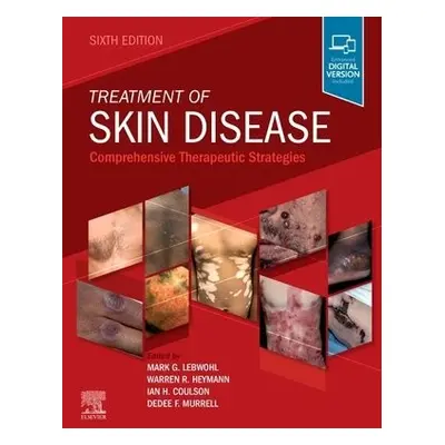 Treatment of Skin Disease - Lebwohl, Mark a Coulson, Ian H., BSc, MB, FRCP a Murrell, Dedee, MA,