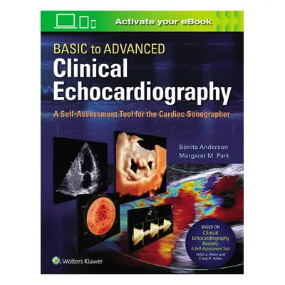 Basic to Advanced Clinical Echocardiography - Anderson, Bonita a Park, Margaret M.