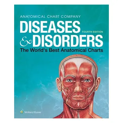 Diseases a Disorders - Anatomical Chart Company