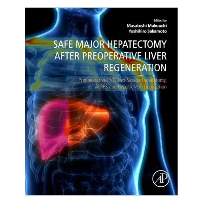 Safe Major Hepatectomy after Preoperative Liver Regeneration