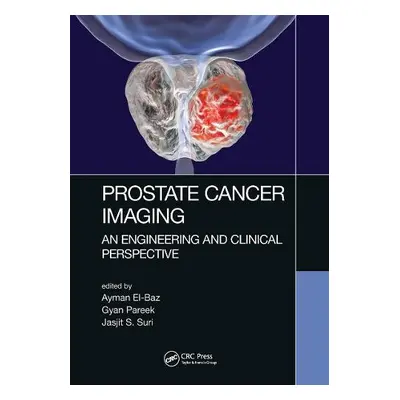 Prostate Cancer Imaging